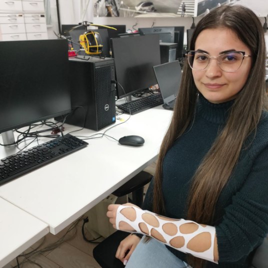 Orteza „elastică”, inovația ce revoluționează aparatele ortopedice pentru mâini. Materialul din care este făcută FOTO