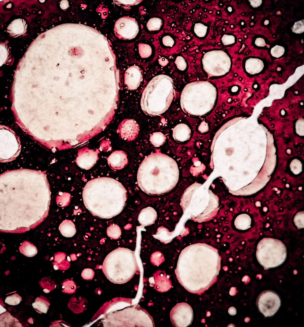 STUDIU A fost descoperit mecanismul prin care celulele canceroase scapă de acțiunea sistemului imunitar