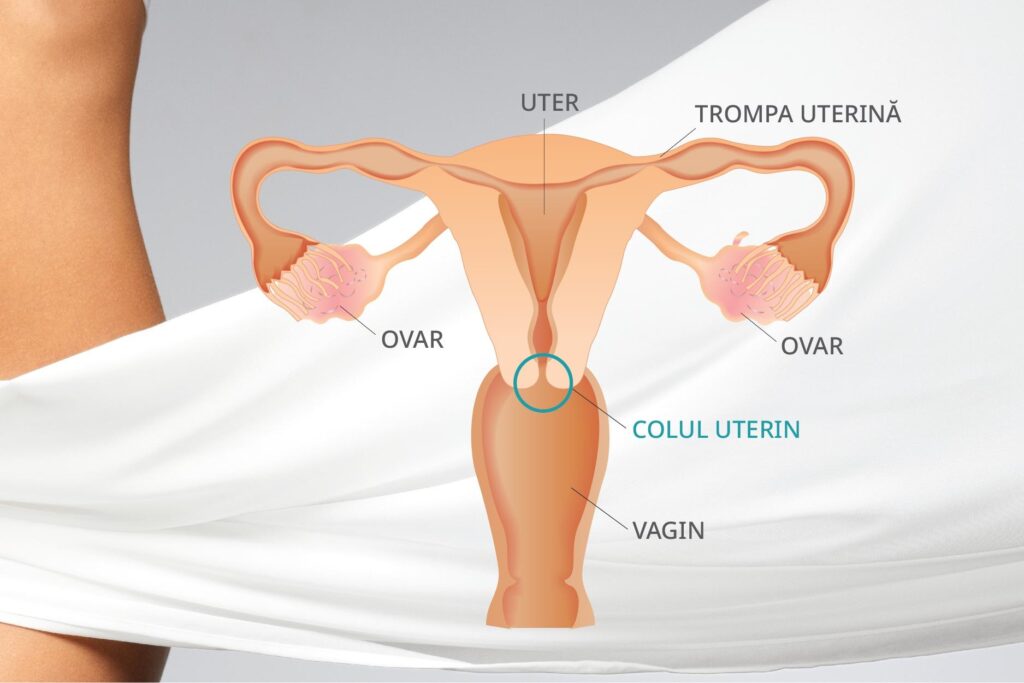 Cancerul de col uterin poate fi prevenit! Ce este cancerul de col uterin?