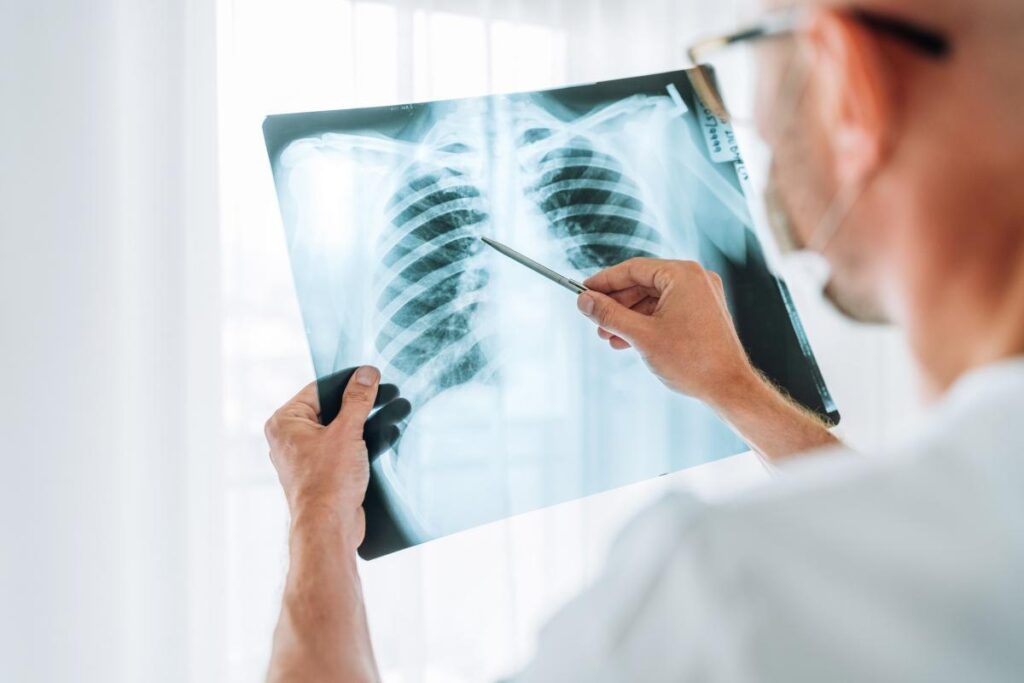 A crescut îngrijorător numărul cazurilor de cancer pulmonar la nefumători. Ce spun specialiştii despre principala cauză