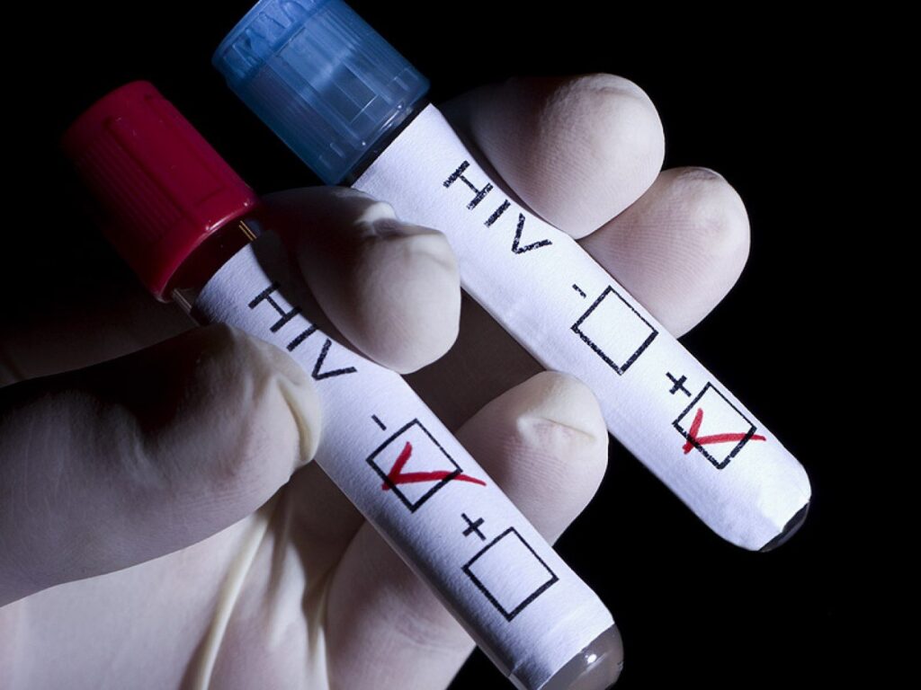 Infecția cu HIV nu mai este o condamnare la moarte. Specialist: „Bolnavii pot trăi chiar mai mult decât persoanele care nu sunt infectate”