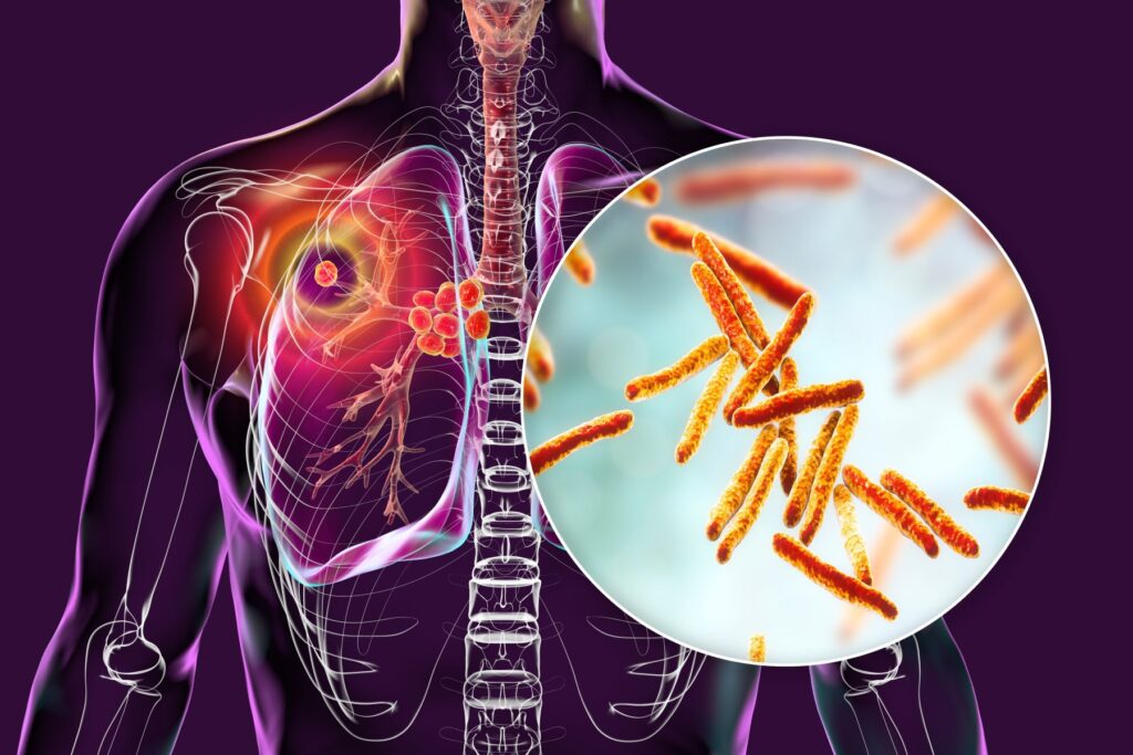 Ce trebuie să facă Europa pentru a reduce mortalitatea cauzată de boli precum HIV, TBC, hepatitele virale și ITS. Care e situația în România